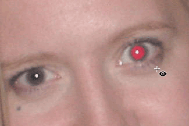 روش دوم رفع قرمزی چشم