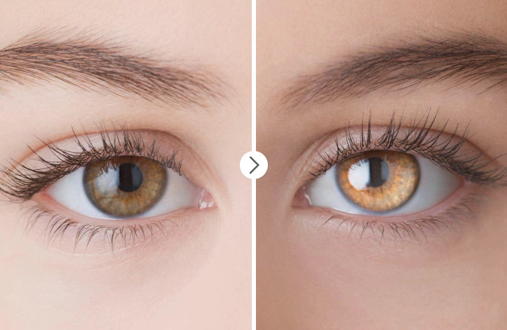 آموزش ایجاد شفافیت و درخشش مصنوعی در چشم