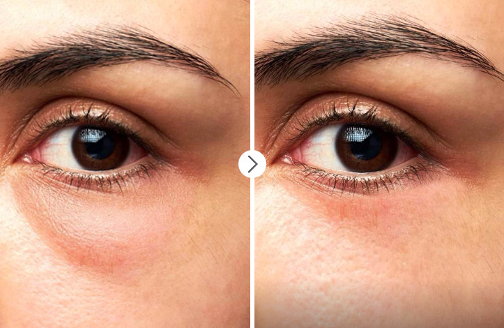 نحوه از بین بردن پف زیر چشم در فتوشاپ